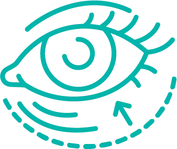 Illustration of an eye demonstrating a blepharoplasty